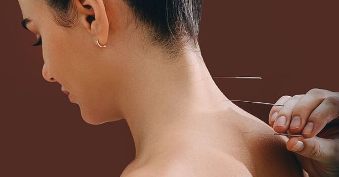 Initial Acupuncture Consult and Treatments